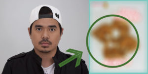 gloc-9