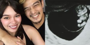 Barbara Romnick sonogram baby