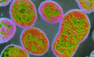 More Than 6,000 People in China Tested Positive for Brucellosis