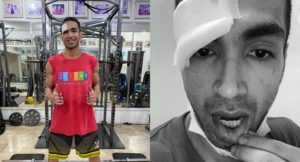 Carlos Agassi Involved in an Accident During Workout at the Gym