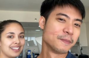 Mikael Daez