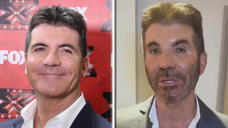 Simon Cowell’s Face Almost Unrecognizable According to Fans