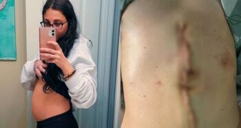 stomach ache to tumors