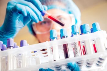 PCSO Medical Assistance for Laboratory