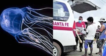 box jellyfish