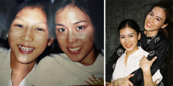 Alex Gonzaga Toni Gonzaga