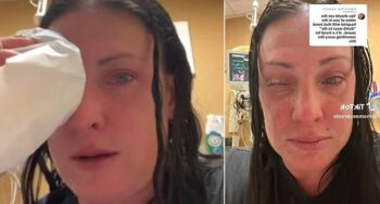 superglue as eye drops