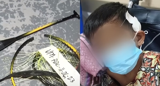 9-Year-Old Child Injured After Being Struck with Badminton Racket by ...