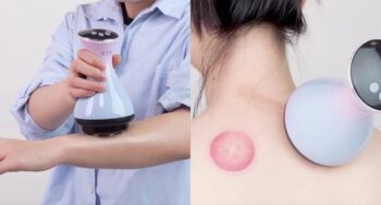 Electric Cupping Massager