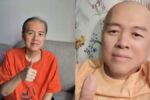 Doc Willie Ong Cancer