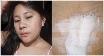 Cesarean Mom