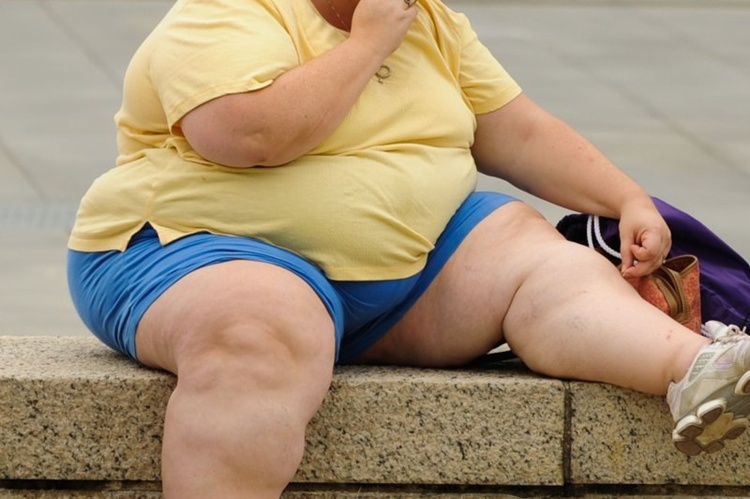 Weight loss drug, obese person