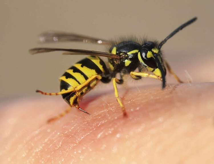 bee sting