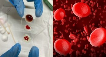 blood type