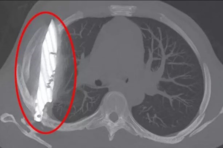 Male Patient