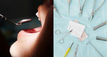 dental procedure