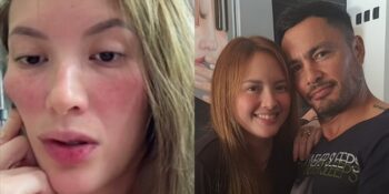 Ellen Adarna, Derek Ramsay 1